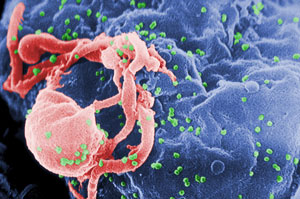 budding HIV (source: Wikipdia)